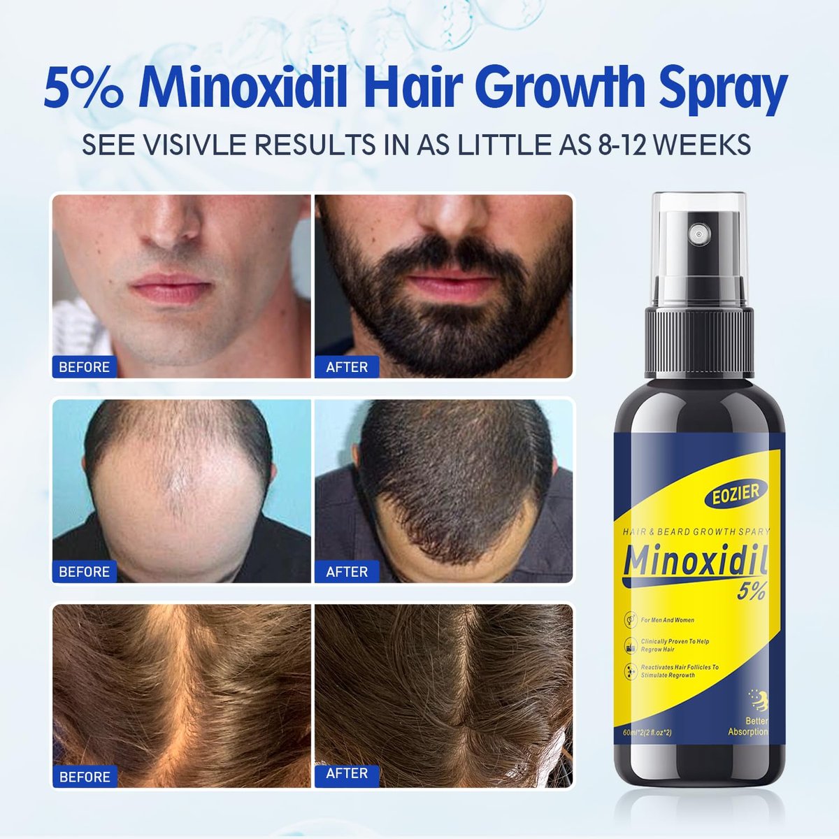 5% Minoxidil with Biotin for Women & Men – Hair Regrowth Spray, Beard & Mustache Growth, Improves Thinning Hair (4 FL OZ / 120 mL) - görsel 11