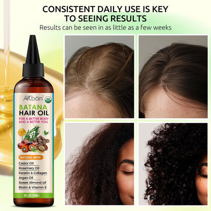 AKBAN Hair Growth Oil – 100% Pure Batana, Castor, Rosemary & Pumpkin Seed Oils with Biotin, Keratin & Vitamin E – Strengthening & Thickening Treatment for Healthy Hair – 4 FL OZ Avelisse