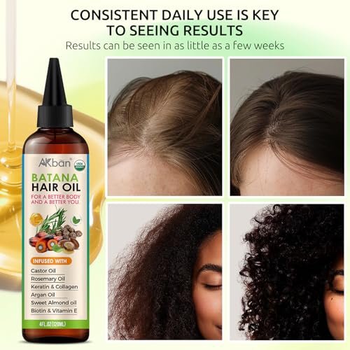 AKBAN Hair Growth Oil – 100% Pure Batana, Castor, Rosemary & Pumpkin Seed Oils with Biotin, Keratin & Vitamin E – Strengthening & Thickening Treatment for Healthy Hair – 4 FL OZ Avelisse