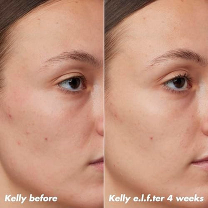 e.l.f. SKIN PLZ Clarify Facial Oil - Acne Treatment Face Oil with Salicylic Acid, Vegan & Cruelty-Free, 1 oz Avelisse
