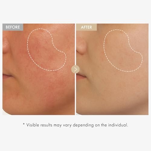 TOSOWOONG Real Rice Glow Serum with 80% Rice Bran Water and Niacinamide for Dark Spots, Uneven Skin Tone, Dull Skin, Radiant Glow, Daily K-Beauty Skincare for All Skin Types, 33ml / 1.11 fl. oz. - görsel 4