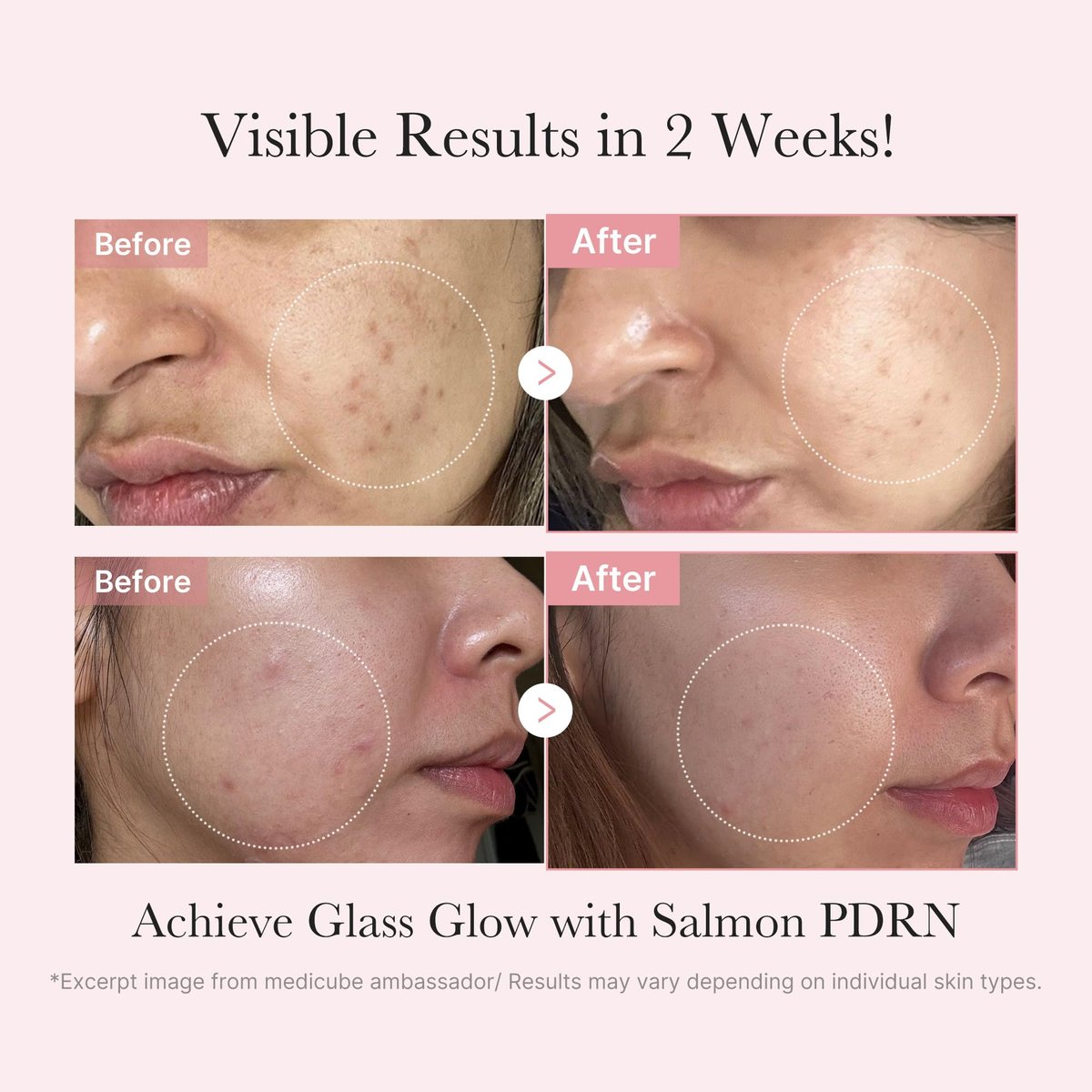 medicube Salmon DNA PDRN Trial Kit – Glass Glow Mini Skincare Set with Toner, Serum & Sheet Mask for Hydrating, Firming, Moisturizing | Travel Essentials for Women & Girls | Korean Skincare - görsel 6