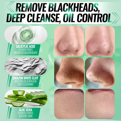 SYABO 2.0 Nose Pore Strips – Blackhead Remover Mask with Salicylic Acid, 100 PCS Deep Cleansing Peel Off Strips for Face (1.7 Ounce) Avelisse