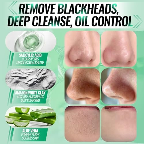 SYABO 2.0 Nose Pore Strips – Blackhead Remover Mask with Salicylic Acid, 100 PCS Deep Cleansing Peel Off Strips for Face (1.7 Ounce) Avelisse