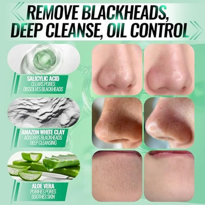 SYABO 2.0 Nose Pore Strips – Blackhead Remover Mask with Salicylic Acid, 100 PCS Deep Cleansing Peel Off Strips for Face (1.7 Ounce) Avelisse
