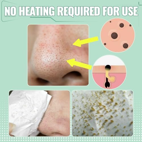 SYABO 2.0 Nose Pore Strips – Blackhead Remover Mask with Salicylic Acid, 100 PCS Deep Cleansing Peel Off Strips for Face (1.7 Ounce) Avelisse