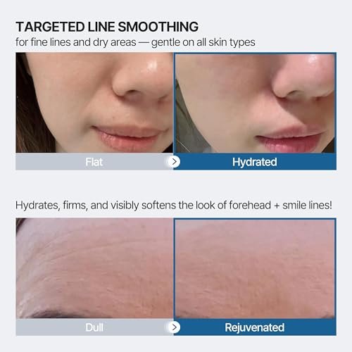 Honeydew Labs Wrinkle Patches for Forehead and Smile Lines – 36 PCS Anti Wrinkle Patches with Hyaluronic Acid, Collagen & Peptides – Overnight Face Tape for Smoothing, Firming & Moisturizing Avelisse
