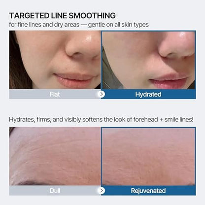Honeydew Labs Wrinkle Patches for Forehead and Smile Lines – 36 PCS Anti Wrinkle Patches with Hyaluronic Acid, Collagen & Peptides – Overnight Face Tape for Smoothing, Firming & Moisturizing Avelisse