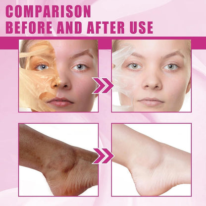 Extra Strong Chemical Peel for Face & Body – Dark Skin Remover & Exfoliant Solution, Gentle Formula for All Skin Types, 3.7 oz