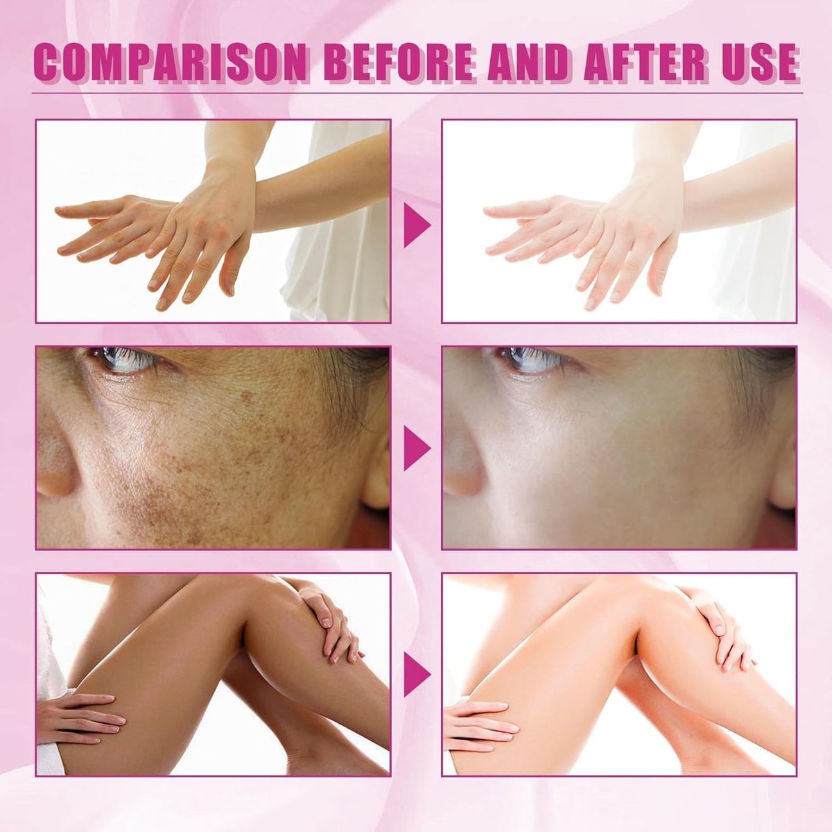 Extra Strong Chemical Peel for Face & Body – Dark Skin Remover & Exfoliant Solution, Gentle Formula for All Skin Types, 3.7 oz - görsel 5