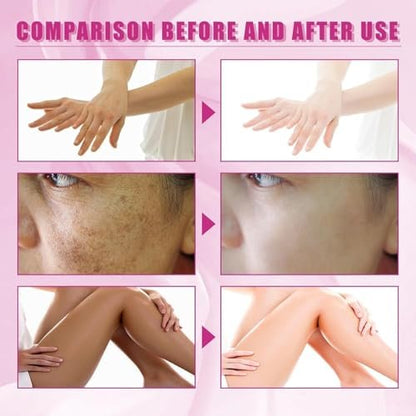 Extra Strong Chemical Peel for Face & Body – Dark Skin Remover & Exfoliant Solution, Gentle Formula for All Skin Types, 3.7 oz