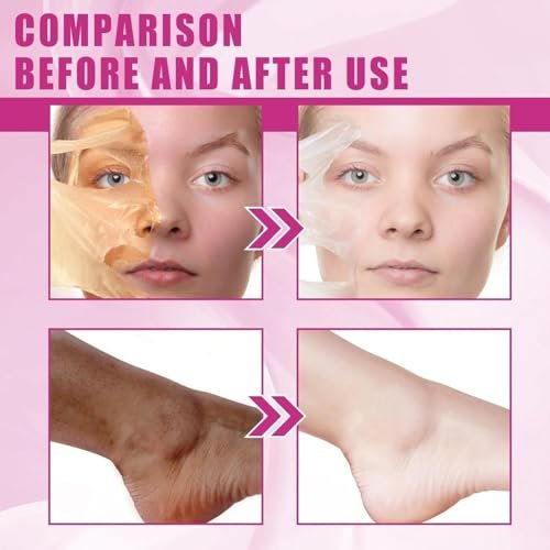 Extra Strong Chemical Peel for Face & Body – Dark Skin Remover & Exfoliant Solution, Gentle Formula for All Skin Types, 3.7 oz - görsel 4