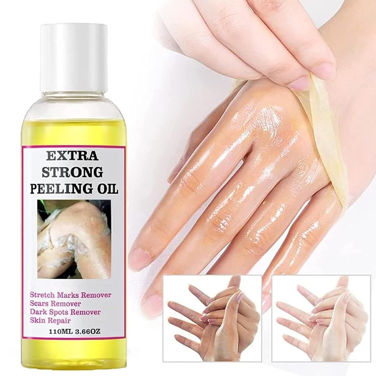 Extra Strong Chemical Peel for Face & Body – Dark Skin Remover & Exfoliant Solution, Gentle Formula for All Skin Types, 3.7 oz - görsel 8