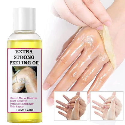 Extra Strong Chemical Peel for Face & Body – Dark Skin Remover & Exfoliant Solution, Gentle Formula for All Skin Types, 3.7 oz