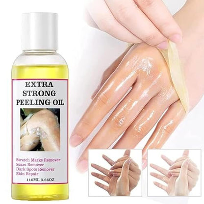 Extra Strong Chemical Peel for Face & Body – Dark Skin Remover & Exfoliant Solution, Gentle Formula for All Skin Types, 3.7 oz