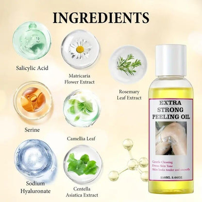 Extra Strong Chemical Peel for Face & Body – Dark Skin Remover & Exfoliant Solution, Gentle Formula for All Skin Types, 3.7 oz