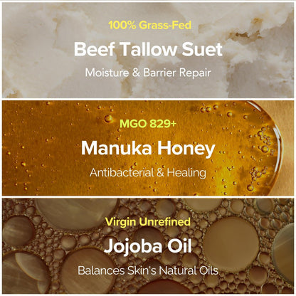 Cinder Brands 100% Grass-Fed Suet Beef Tallow and Manuka Honey Balm - Natural Moisturizer Cream with Vitamin E Oil for Face & Body, Eczema Relief for Dry Skin, Pure Tallow Face Moisturizer for Sensitive Skin (4 Fl Oz) Avelisse