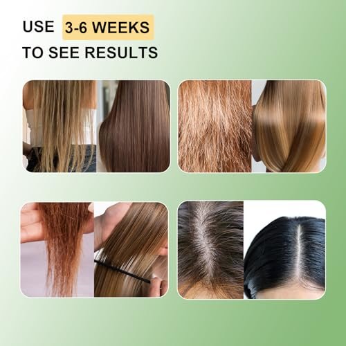 Umex Batana Oil Hair Care Set – Nourishing Shampoo & 4-in-1 Hair Oil with Rosemary, Castor & Pumpkin Seed Oils for Hair Growth, Strengthening & Deep Clean – All Hair Types Avelisse