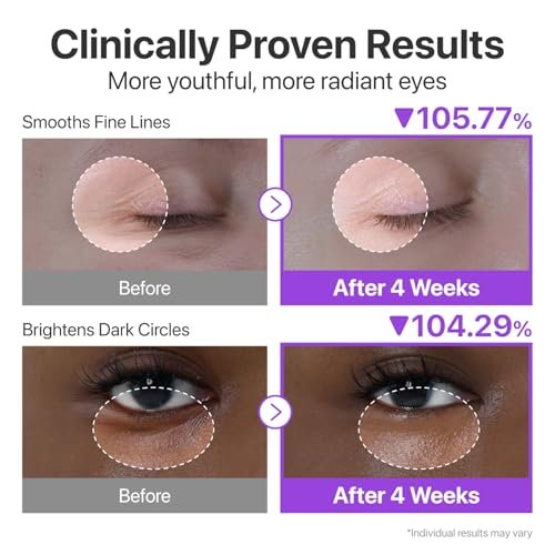 numbuzin No.9 NAD+ Retinol Eye Cream - Depuffing & Firming Eye Serum for Dark Circles, Wrinkles & Fine Lines with Peptides & Niacinamide, 0.33 fl oz Avelisse