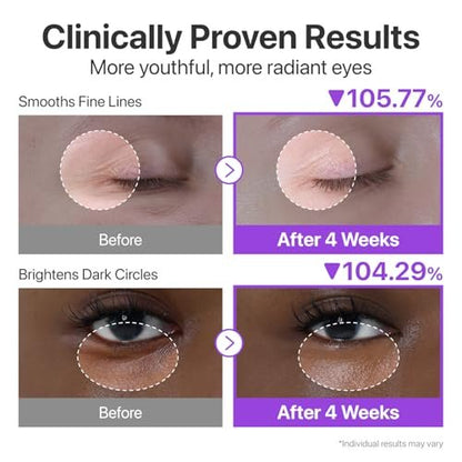 numbuzin No.9 NAD+ Retinol Eye Cream - Depuffing & Firming Eye Serum for Dark Circles, Wrinkles & Fine Lines with Peptides & Niacinamide, 0.33 fl oz Avelisse