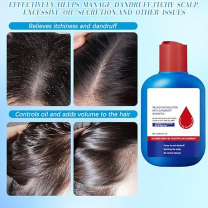 HONGYUNDA Anti-Dandruff Shampoo - Oil Control & Refreshing Hair Care Cleansing for Men and Women (1 Fl Oz) Avelisse