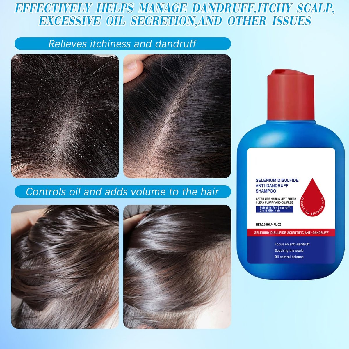 HONGYUNDA Anti-Dandruff Shampoo - Oil Control & Refreshing Hair Care Cleansing for Men and Women (1 Fl Oz) Avelisse