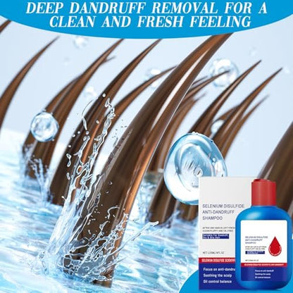 HONGYUNDA Anti-Dandruff Shampoo - Oil Control & Refreshing Hair Care Cleansing for Men and Women (1 Fl Oz) Avelisse