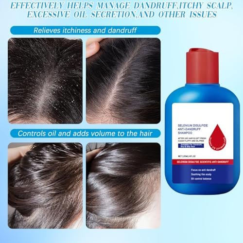 CLYXQP Anti-Dandruff Shampoo - Oil Control Formula for Men and Women, 120ml Avelisse