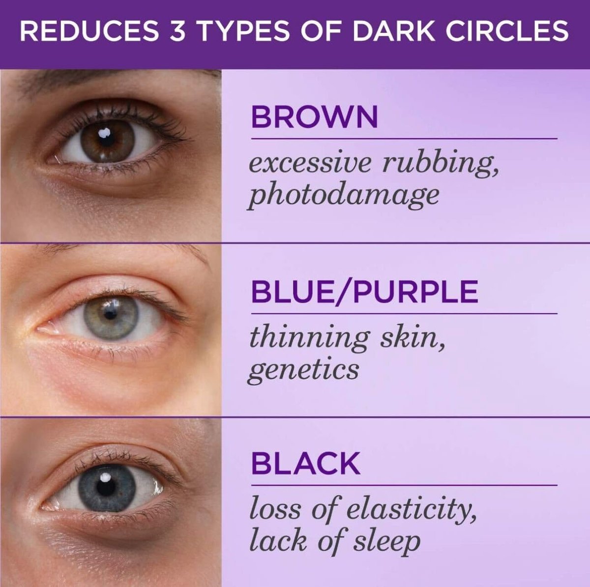 TATCHA The Brightening Eye Cream – Vitamin C Eye Cream for Dark Circles & Firm Undereyes, 0.5 fl oz Avelisse