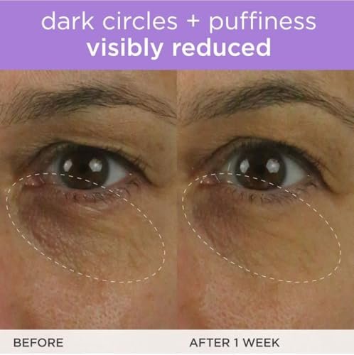 TATCHA The Brightening Eye Cream – Vitamin C Eye Cream for Dark Circles & Firm Undereyes, 0.5 fl oz Avelisse