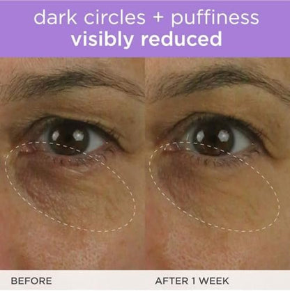 TATCHA The Brightening Eye Cream – Vitamin C Eye Cream for Dark Circles & Firm Undereyes, 0.5 fl oz Avelisse