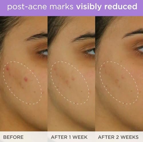 TATCHA The Brightening Serum – Vitamin C Treatment for Brighter, Firmer Skin, Targets Hyperpigmentation & Fades Post-Acne Marks, 30 ml / 1.0 fl. oz. Avelisse