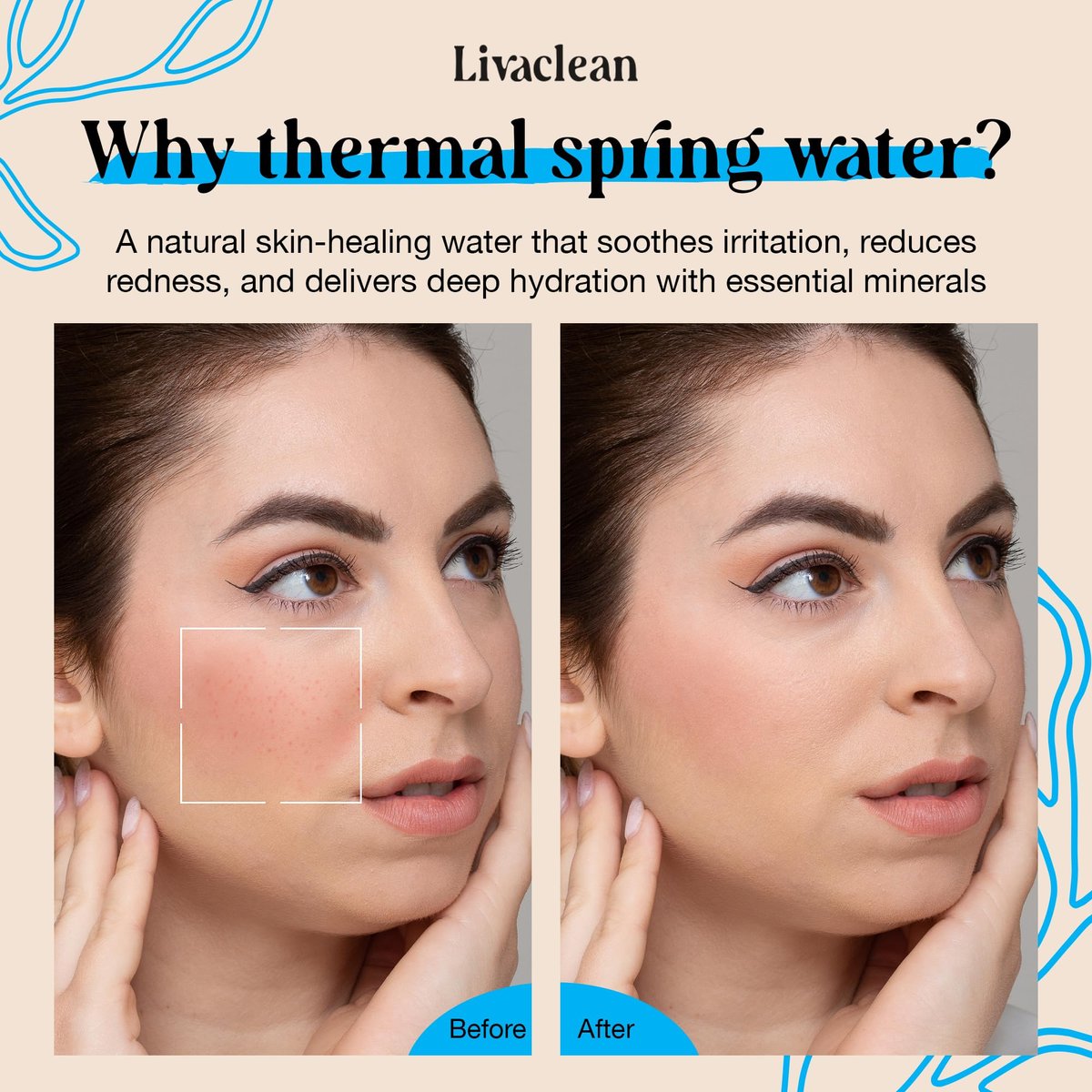 LivaClean Thermal Spring Water Face Spray Mist with Hyaluronic Acid & Aloe Vera – Hydrating, Soothing, Mineral-Rich Face Mist (300ml + 50ml) Avelisse
