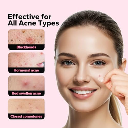 CharmCherry Pimple Patches for Face (18 Count) - Microdart Acne Patches with Salicylic Acid, Hydrocolloid Blemish Spot Treatment for Early Stage Deep Pimples, Zits, Breakouts & Cystic Acne