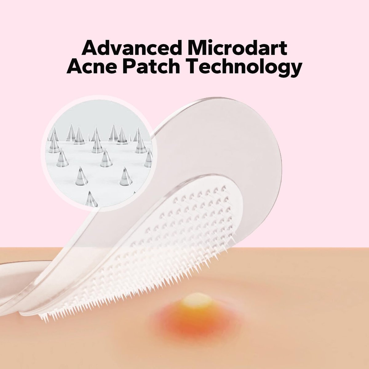 CharmCherry Pimple Patches for Face (18 Count) - Microdart Acne Patches with Salicylic Acid, Hydrocolloid Blemish Spot Treatment for Early Stage Deep Pimples, Zits, Breakouts & Cystic Acne - görsel 3
