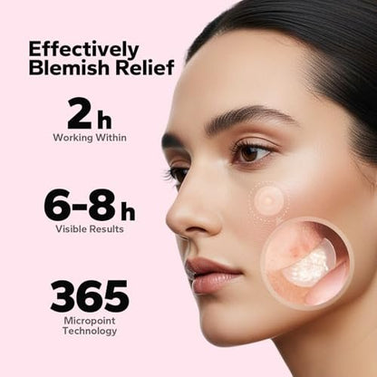 CharmCherry Pimple Patches for Face (18 Count) - Microdart Acne Patches with Salicylic Acid, Hydrocolloid Blemish Spot Treatment for Early Stage Deep Pimples, Zits, Breakouts & Cystic Acne