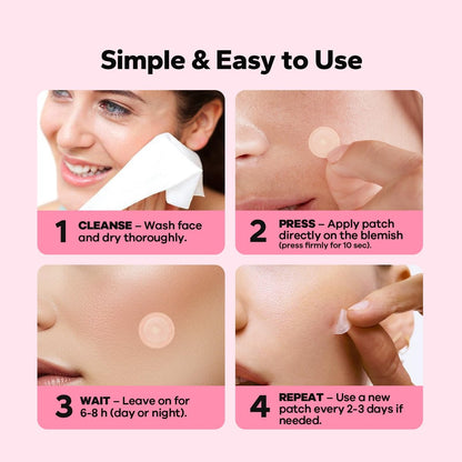 CharmCherry Pimple Patches for Face (18 Count) - Microdart Acne Patches with Salicylic Acid, Hydrocolloid Blemish Spot Treatment for Early Stage Deep Pimples, Zits, Breakouts & Cystic Acne