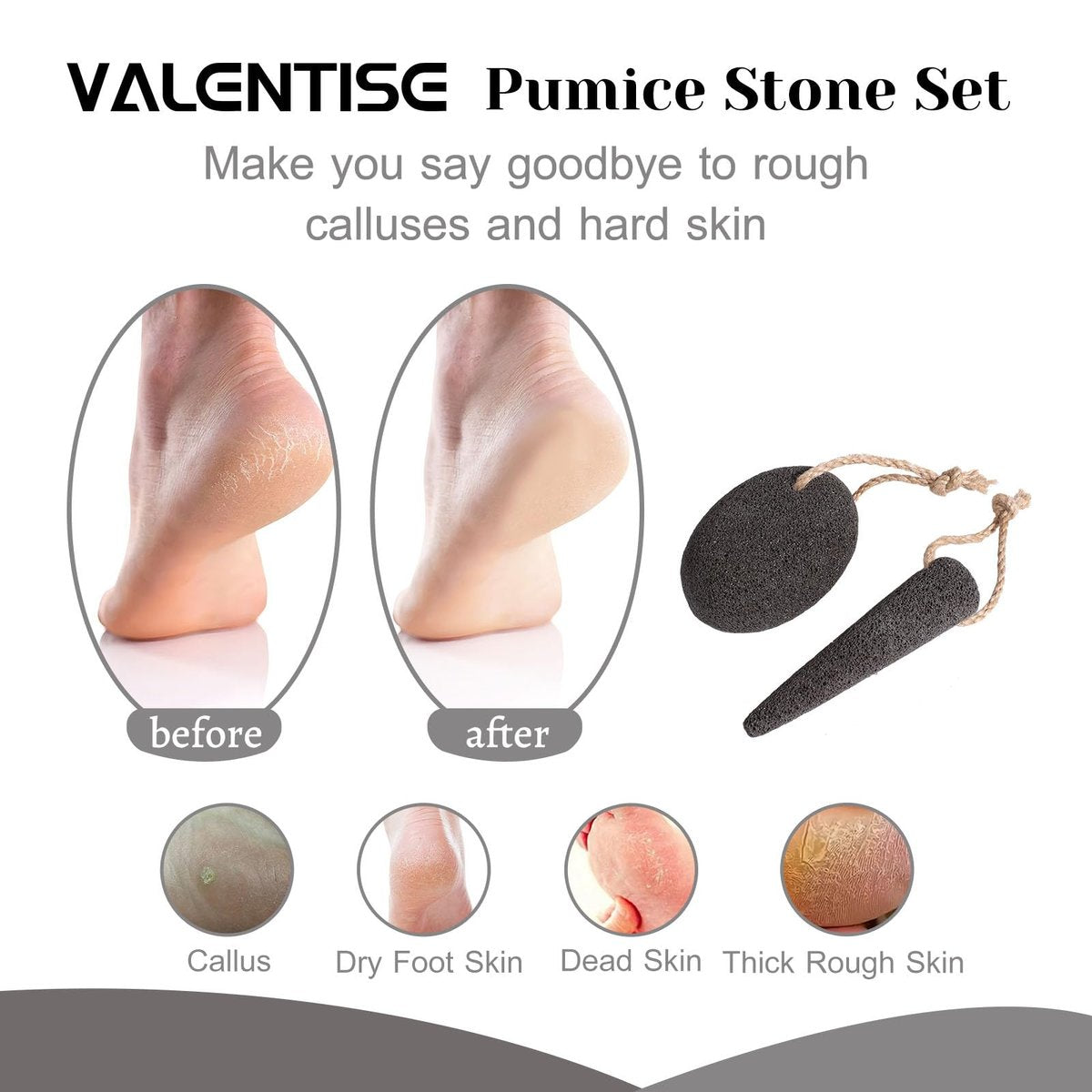 VALENTISE Pumice Stone Set - 2 Pack Natural Volcanic Foot Scrubbers for Dead Skin & Calluses, Pedicure Exfoliation Tools for Feet and Hands Avelisse