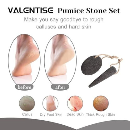 VALENTISE Pumice Stone Set - 2 Pack Natural Volcanic Foot Scrubbers for Dead Skin & Calluses, Pedicure Exfoliation Tools for Feet and Hands Avelisse