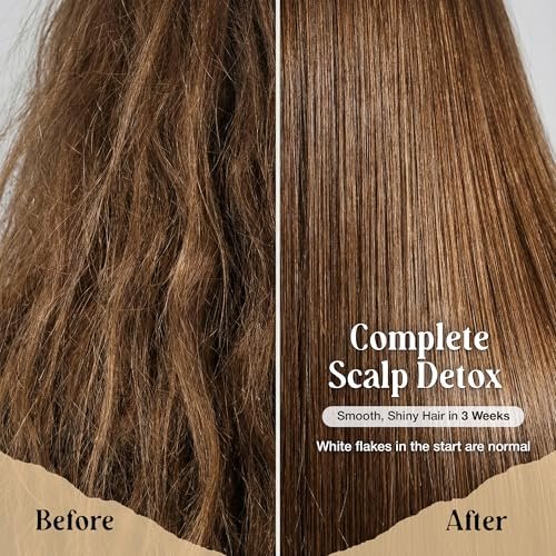 2 Pack Rice Water Shampoo and Conditioner Bars - 2x100g - Hair Soap with Spirulina, Matcha, Hyaluronic Acid & Coconut - Sulfate-Free, Paraben-Free - Rice Soap for Hair Growth Avelisse