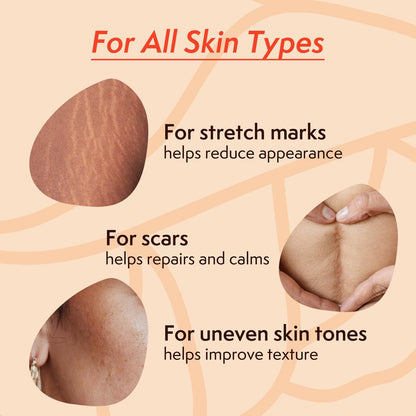 Nature Spell Stretch Mark Oil for Women - Vegan Body Oil for Stretch Marks, Scars & Uneven Skin Tone, 3.38 Fl Oz Avelisse
