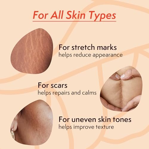 Nature Spell Stretch Mark Oil for Women - Vegan Body Oil for Stretch Marks, Scars & Uneven Skin Tone, 3.38 Fl Oz Avelisse