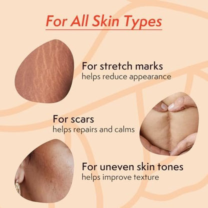 Nature Spell Stretch Mark Oil for Women - Vegan Body Oil for Stretch Marks, Scars & Uneven Skin Tone, 3.38 Fl Oz Avelisse