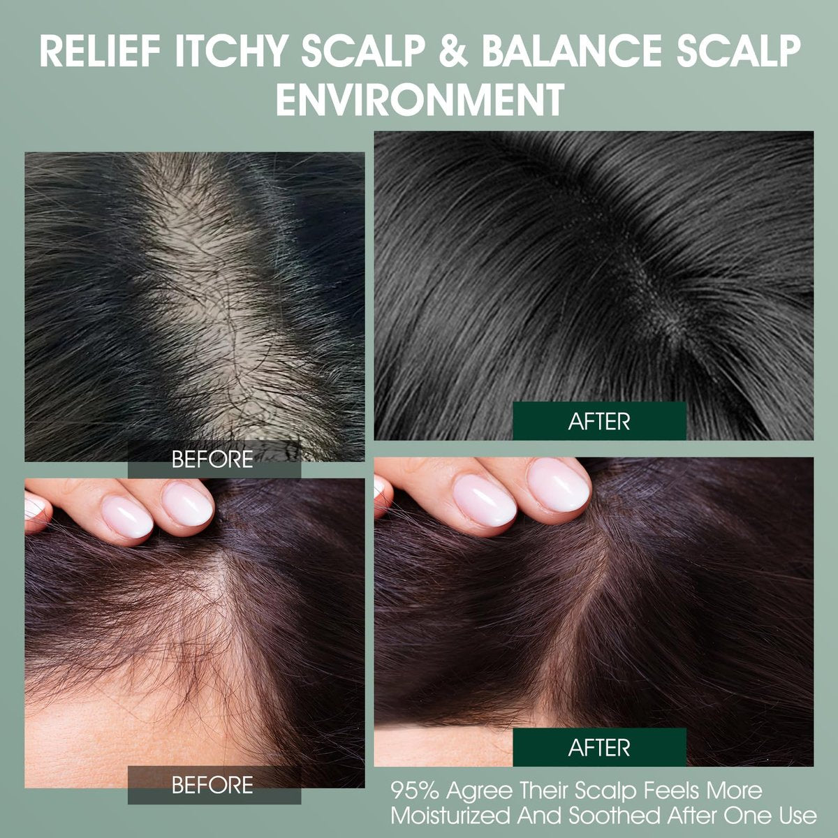 VOERUY Rosemary Refreshing Scalp Treatment with Tea Tree - Clarifying Build Up & Purifying Leave-In Scalp Detox for Dry Itchy Scalp - Vegan & Cruelty-Free, 120ML Avelisse