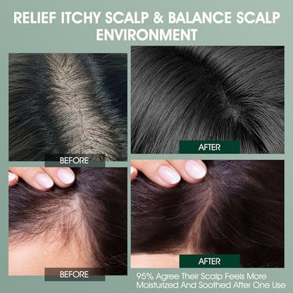 VOERUY Rosemary Refreshing Scalp Treatment with Tea Tree - Clarifying Build Up & Purifying Leave-In Scalp Detox for Dry Itchy Scalp - Vegan & Cruelty-Free, 120ML Avelisse