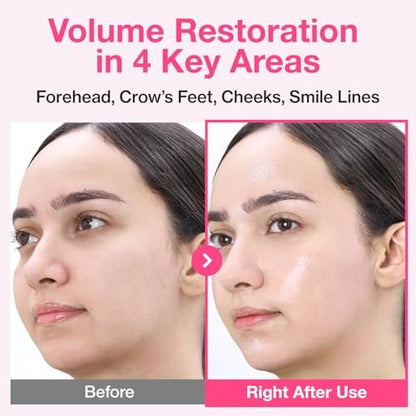 numbuzin No.2 Sheet Mask | Rose PDRN Collagen Plumping Sheet Mask | Brightening, Hydrating, Firming & Moisturizing Korean Face Mask with Collagen & Peptides | 4ea Avelisse