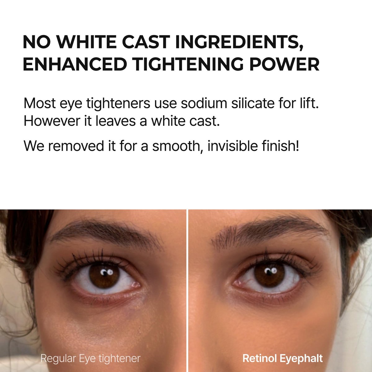 Dr.Melaxin Retinol Eyebag Cream – Puffiness, Dark Circles & Fine Lines Treatment with EGF, Niacinamide & Ceramide, 0.35 Fl Oz Avelisse