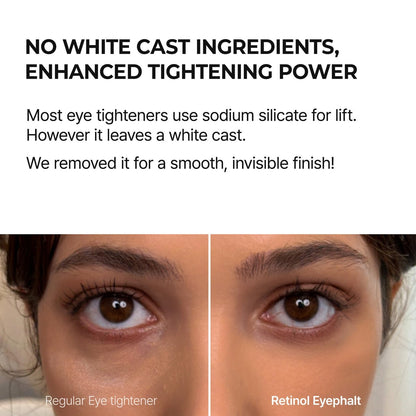 Dr.Melaxin Retinol Eyebag Cream – Puffiness, Dark Circles & Fine Lines Treatment with EGF, Niacinamide & Ceramide, 0.35 Fl Oz Avelisse