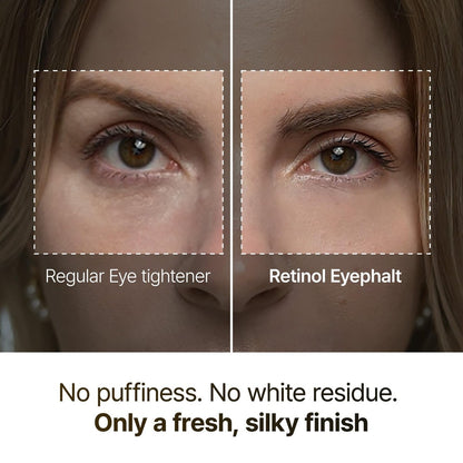Dr.Melaxin Retinol Eyebag Cream – Puffiness, Dark Circles & Fine Lines Treatment with EGF, Niacinamide & Ceramide, 0.35 Fl Oz Avelisse