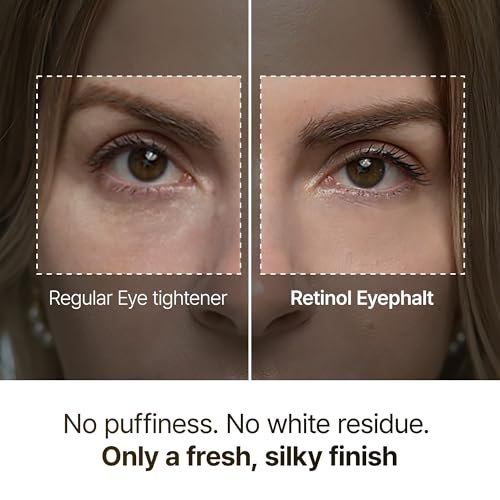 Dr.Melaxin Retinol Eyebag Cream – Puffiness, Dark Circles & Fine Lines Treatment with EGF, Niacinamide & Ceramide, 0.35 Fl Oz Avelisse